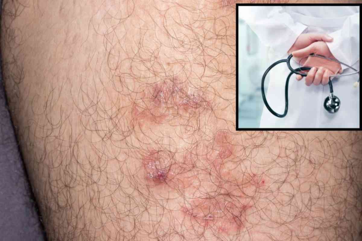 Malattia consulto medico